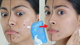 I tested VIRAL SALICYLIC ICE MASK & THIS HAPPENED! | Does the ice mask works instantly? 😳