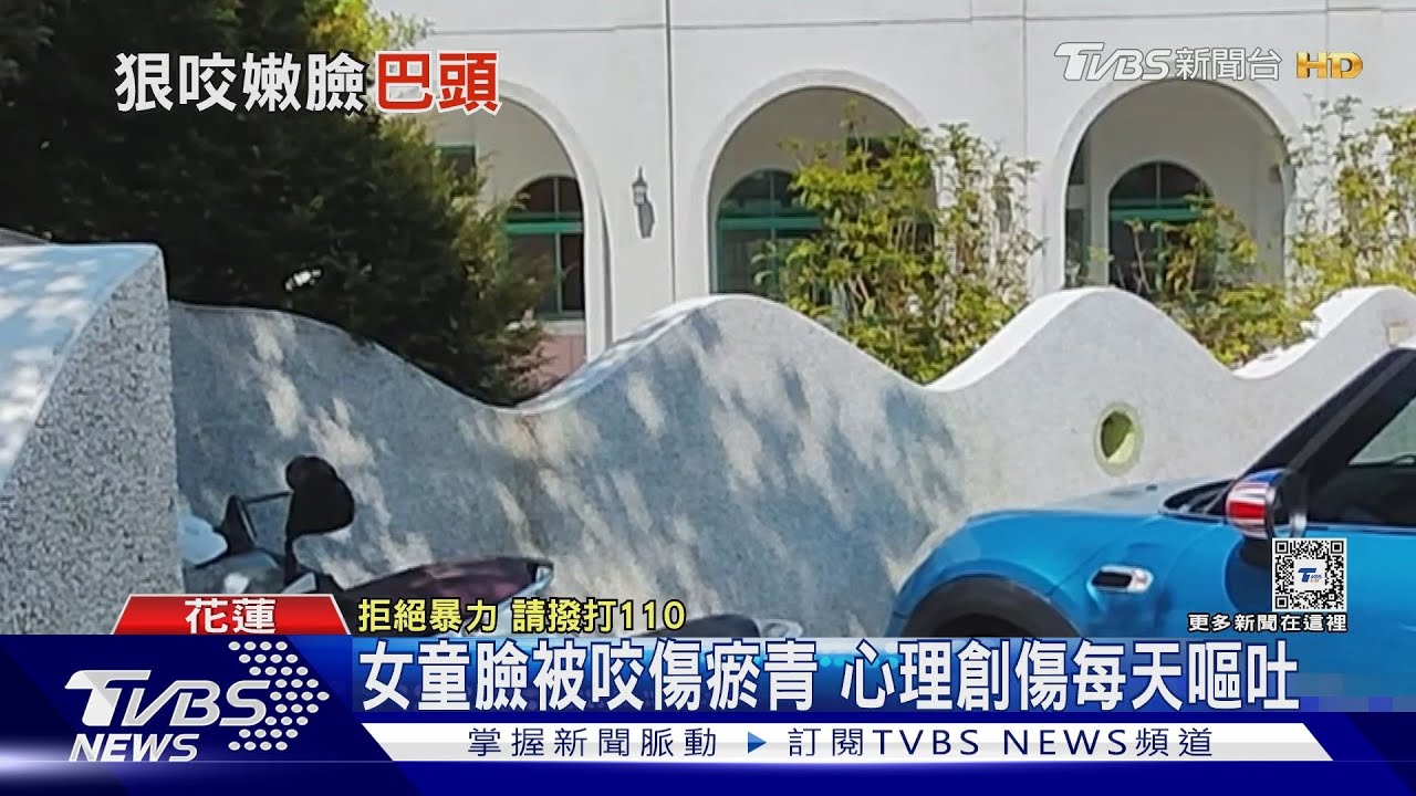 2歲女童遭同學狂打頭26次 家屬控園方漠視