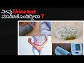 Labdoctor Urine Test ಮೂತ್ರ ಪರೀಕ್ಷೆ Urine Routine And Microscopy In Kannada U