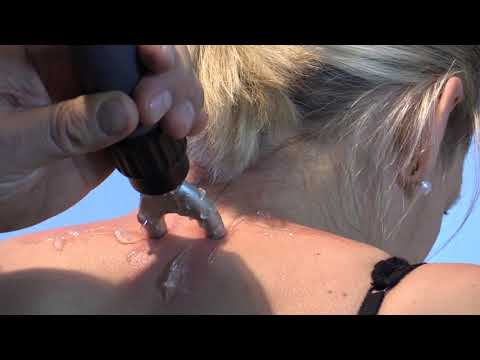 Storz Medical Treatment video Applicateurs Spine Actor Masterpuls