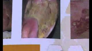 Beyond The Sleeping bag-MASTER.wmv