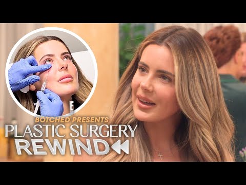 Why Brielle Biermann REGRETS Dissolving Her Under-Eye Filler | Plastic Surgery Rewind | E!