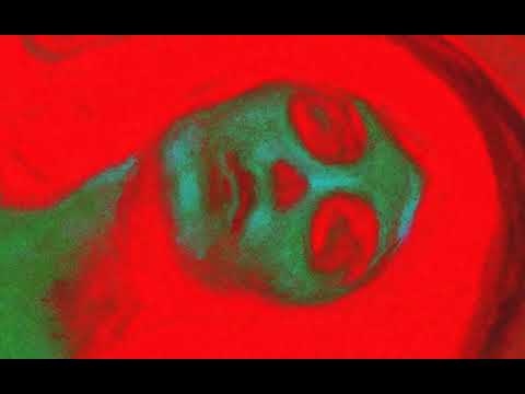 Ichneumonid - She's a star