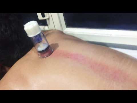 Wie zu verstehen, dass die Schmerzen im Nacken Gelenke und Testosteron