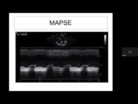 46th Basic Course of Echo, 16-10-22 Measurements-2