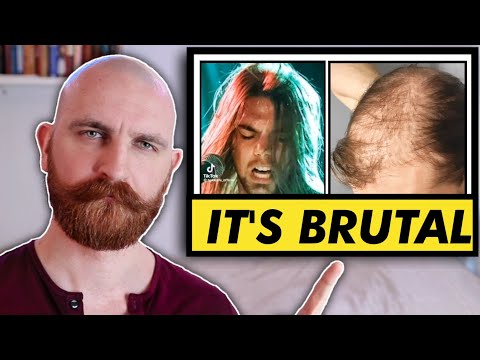 Balding is Depressing (This is WHY)