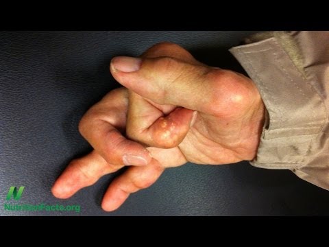 How to Counter the Inflammation of Aging