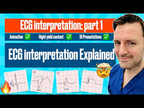 , title : '#ecg interpretation : The animated Visual Guide with ECG Criteria #electrocardiogram'