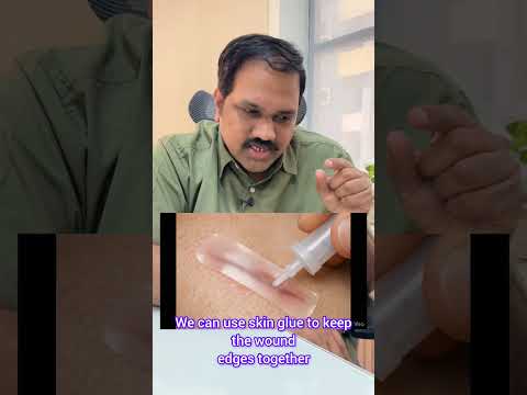 Skin glue and deep wound closure short video thumbnail by Dr. Ram Prabhu.