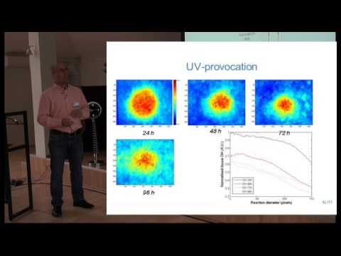 Prof. Göran Salerud: Biophotonics in medical diagnosis, prevention and prediction