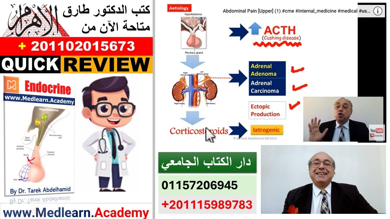 Cushing syndrome (Quick Review) #cme #internal_medicine #usmle #medicalstudent #محاضرات_باطنة