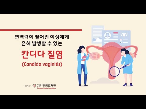 씨젠의료재단_여성의학과_칸디다질염