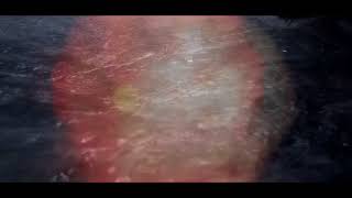 Music video thumbnail preview for TRISOMIE 21 - The Story So Far by Trisomie 21