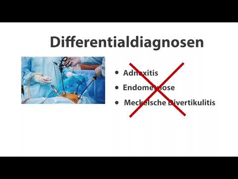 Appendektomie - Erklärfilm Demo