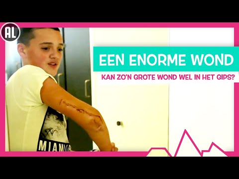 WAT ALS JE HELE ARM EEN WOND IS? - TOPDOKS SEH