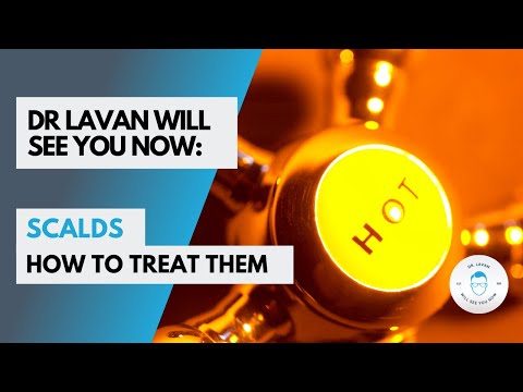 Dr Lavan: Scalds - How to treat scald burns and when to go to hospital