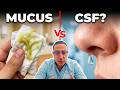 ⭐CSF Leak Symptoms Explained | When a Runny Nose Is NOT Normal
