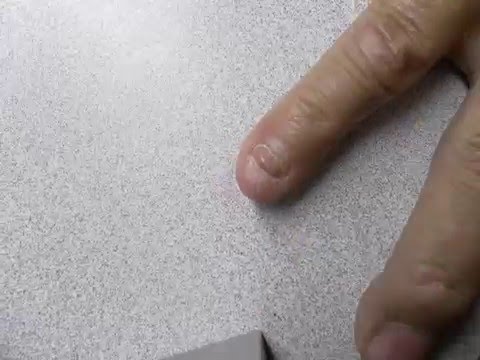 (72) Finger Nail Time Lapse Growing