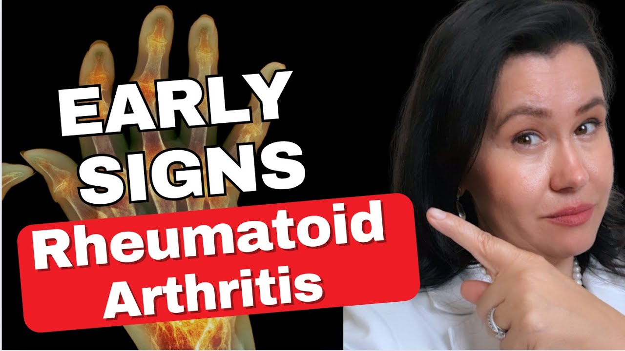 Early Warning Signs Of Rheumatoid Arthritis | Don't Ignore These Vital Symptoms!