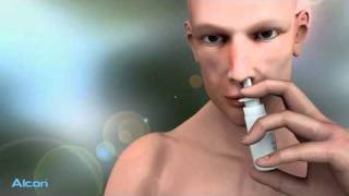 Nasensprays richtig anwenden