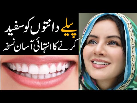My Secret to go from Yellow to White Teeth | Rabi Pirzada
