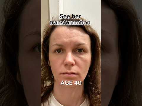 Smooth Forehead in 7 days | Face Fitness | Face Yoga