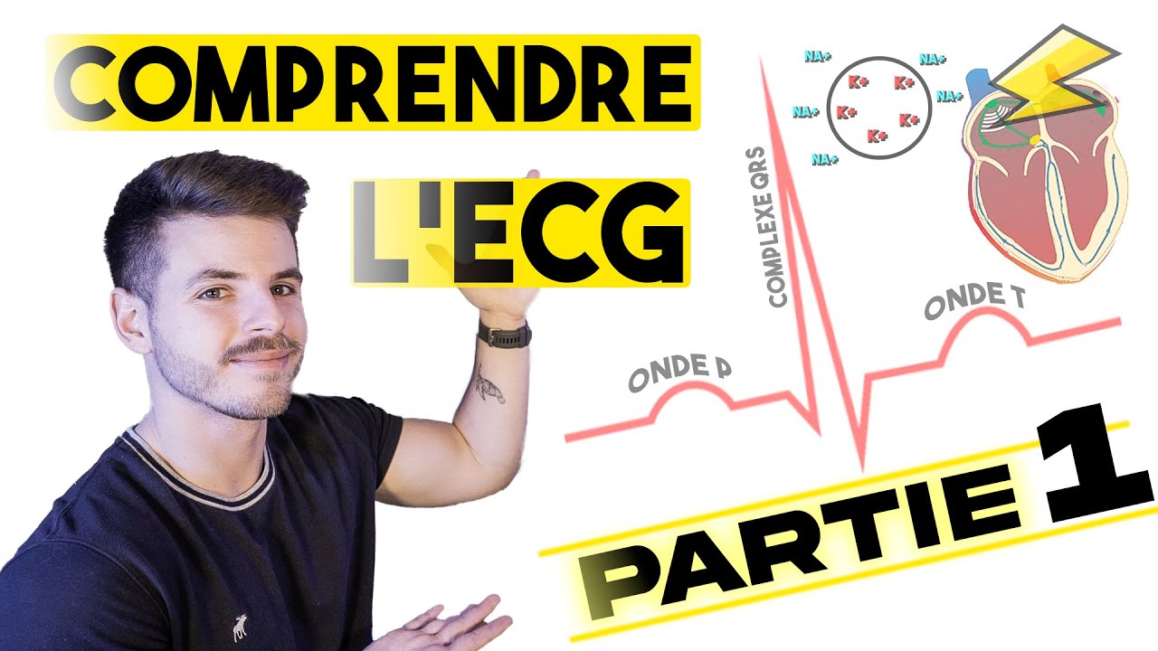 LECTURE D'UN ECG : les bases des bases (partie 1)