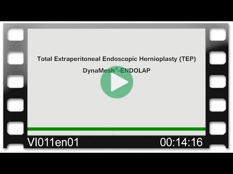 DynaMesh®-ENDOLAP - OR-Video: Total Extraperitoneal Endoscopic Hernioplasty - TEP