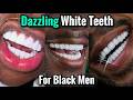 How To Get A Dazzling White Smile For Black Men