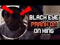 Black Eye PRANK W Funnymike On King FROM NIQUE AND KING