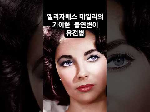 Elizabeth Taylor was born with a double row of eyelashes genetic mutation.