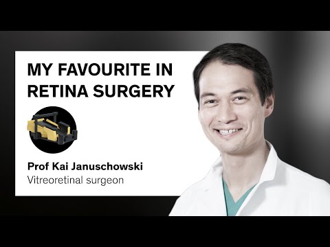 OS 4: All in one experience | What excites me the most about Oertli | Kai Januschowski | #001