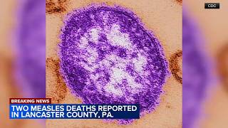 2 unvaccinated people die from measles in Lancaster County, Pennsylvania