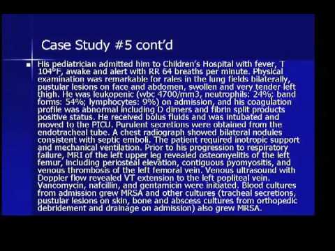 Staphylococcus aureus sepsis syndrome