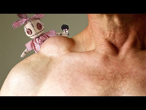 Planting their children into your body - SCP 2386