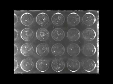 A sleep state in Drosophila larvae required for neural stem cell proliferation