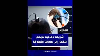 أمل جديد للمصابين بالشلل.. شريحة دماغية تحول الأفكار إلى كلمات منطوقة thumbnail