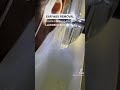 Ear Wax Removal Using The Earigator