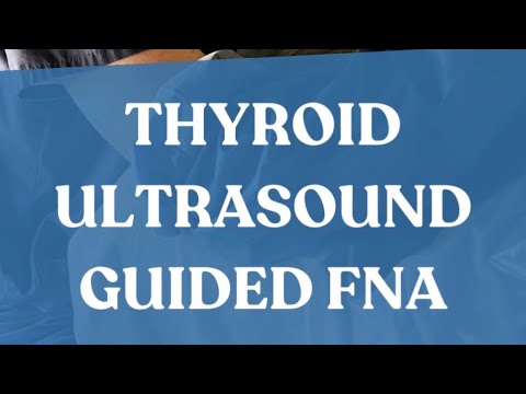 Thyroid Ultrasound Guided FNA