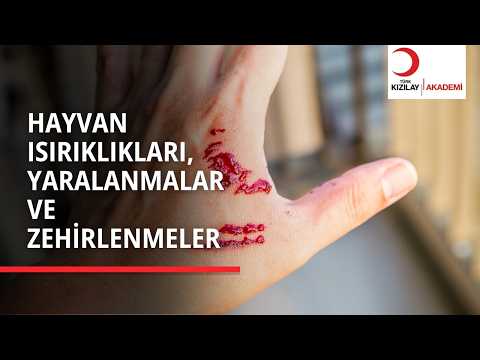 Arı mı Soktu, Denizanası mı? | Yanlış Müdahale Etmeyin!