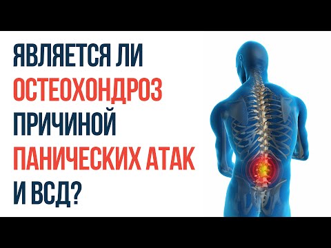Рентген снимки шейного отдела позвоночника Кострома клиника по лечению позвоночника в