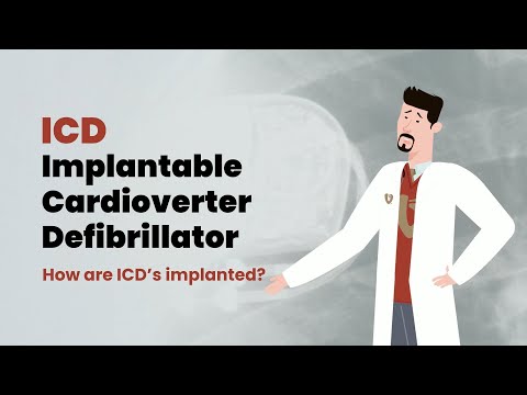 How Does an ICD Work? Your Heart Rhythm Safety Net Explained