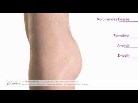 comment augmenter le volume de ses cuisses