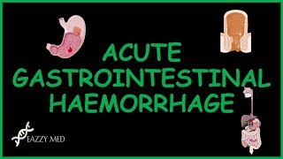 Acute Gastrointestinal Bleeding causes,features,diagnosis and treatment