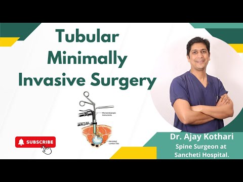 Tubular Minimally Invasive Surgery | Myths & Facts | Dr. Ajay Kothari
