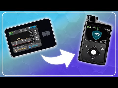 Switching from Tandem t:slim X2 to Medtronic 780g - Pros & Cons