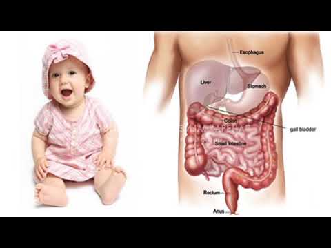 Cistična fibroza - Nasljedna bolest koja je opasna po život