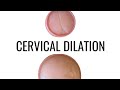 Cervical Dilation Up Close