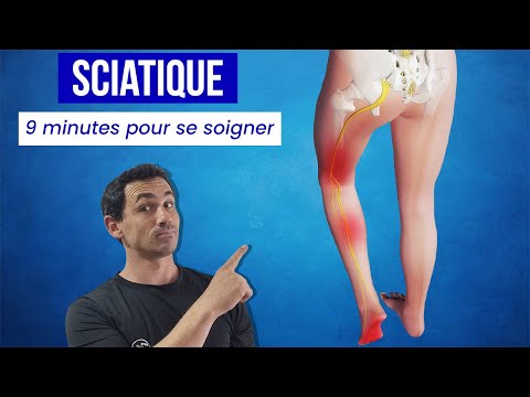 Sciatica: 9 exercises for quick relief