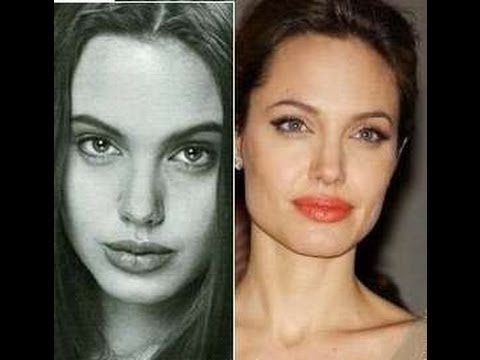 Watch lagu Images Videos Ranker Celebrity Nose Jobs, Watch Images Ranker Celebrity Nose Jobs free Watchn, video klip Ranker Celebrity Nose Jobs